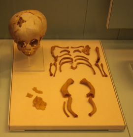 Egyptian Infant Skeleton with OI (not the one discussed in articles) from Museum of London, via Mina Science 